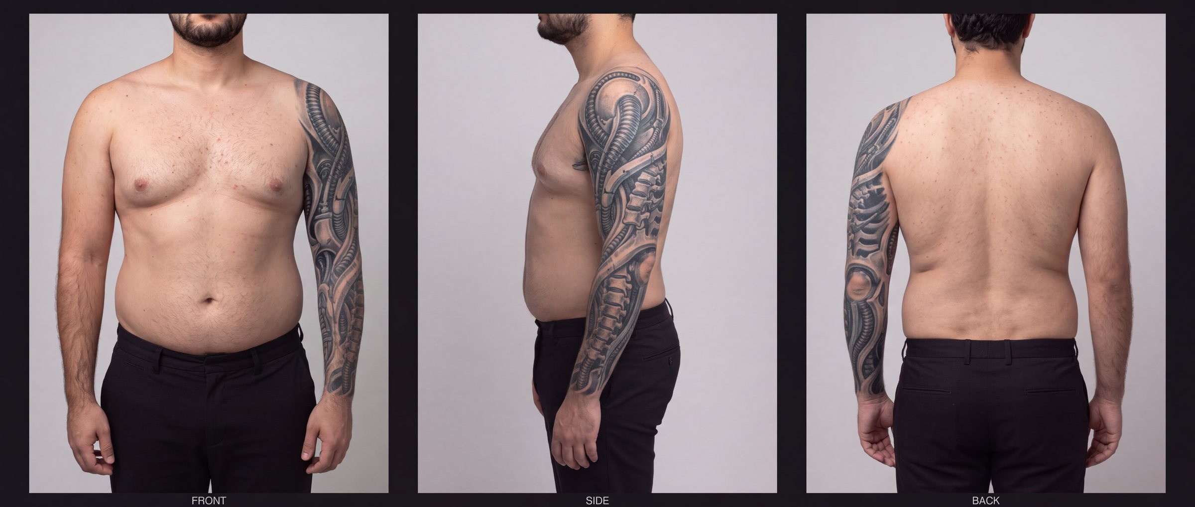 T-10 Biomechanical: front, side and back
